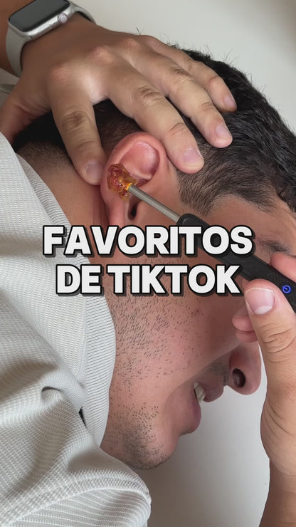 LIMPIA TUS OÍDOS CON VISIÓN HD EN TIEMPO REAL TECNOLOGÍA DE PRECISIÓN DESDE CASA